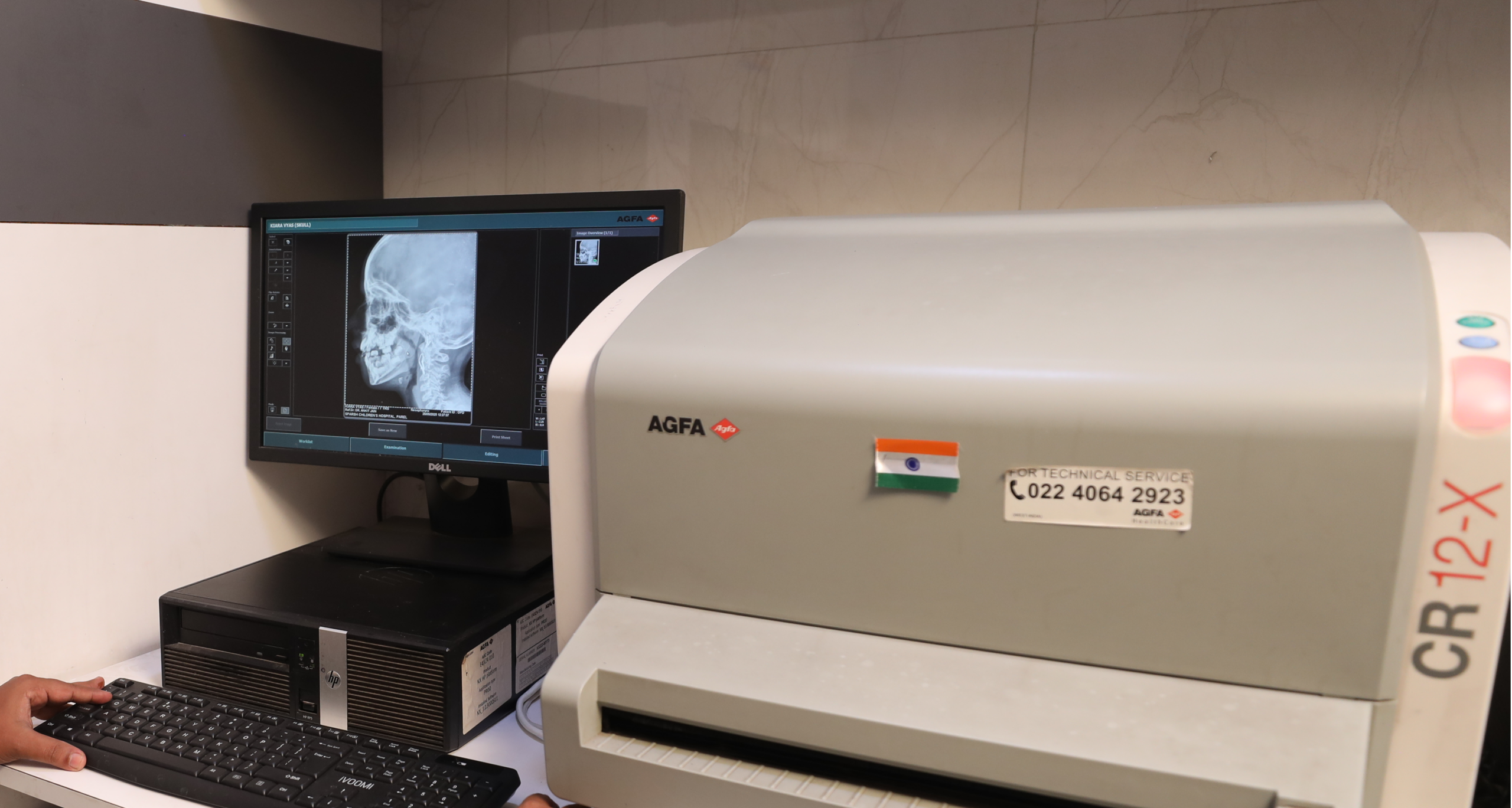 Picture1151 - Sparsh Hospital - Sparsh Hospital Radiology workstation with a monitor showing a side view skull X-ray beside a large medical imaging device labeled AGFA. A hand rests on a keyboard.