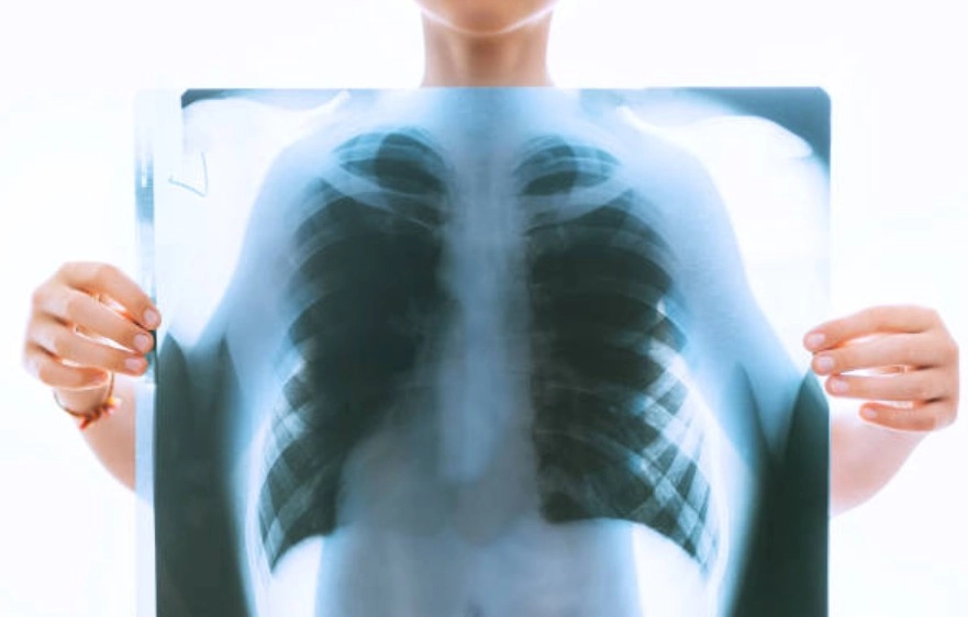 Person holding a chest X-ray film up to light, showing lungs and heart in the image.