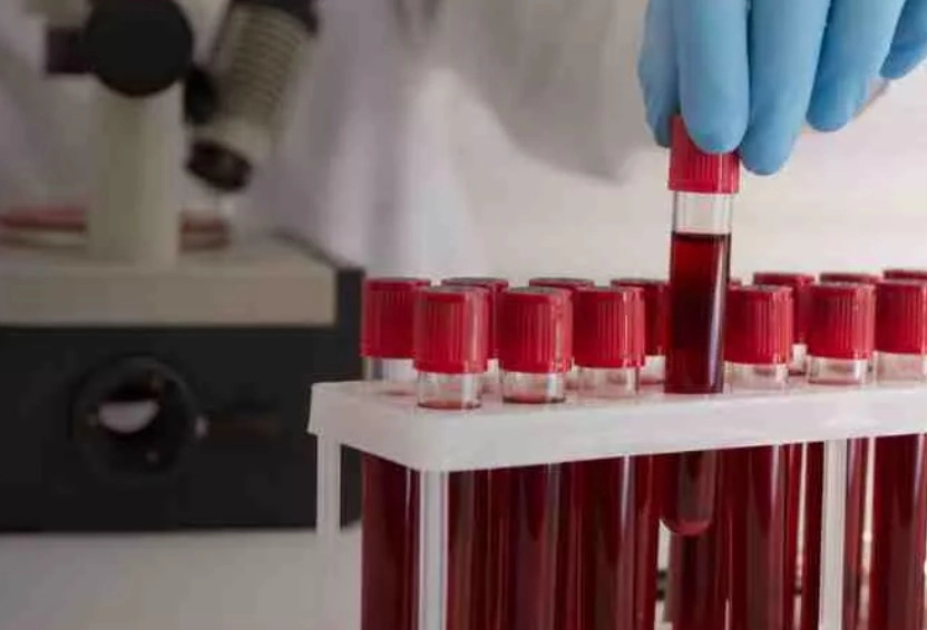 Common Blood Tests - Sparsh Hospital - Sparsh Hospital Gloved hand lifting a blood sample from a rack of red-capped test tubes in a laboratory setting.