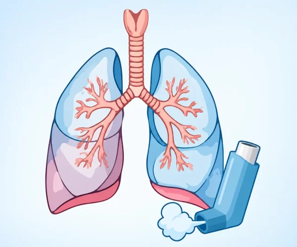 Illustration of human lungs with a blue inhaler delivering medication into the airways, showing the trachea and bronchial branches.
