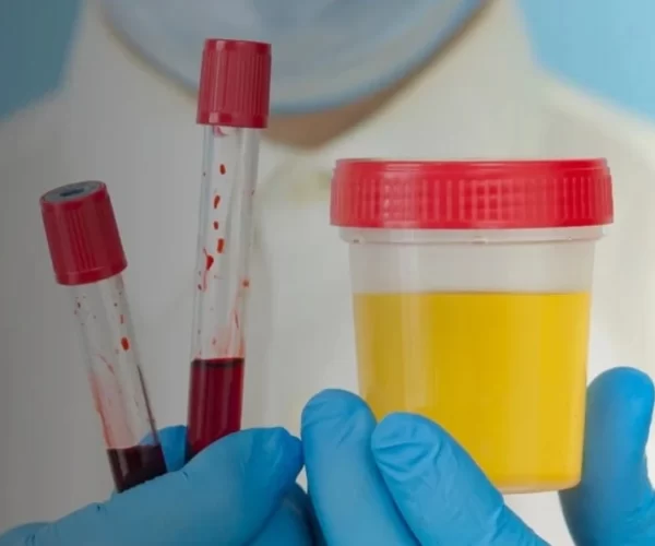 Lab worker in blue gloves holds two blood sample tubes and a urine specimen container in a clinical setting.