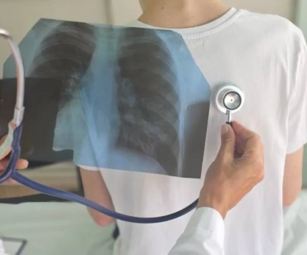 Clinician listening with a stethoscope while a chest X-ray overlay is held against a patient wearing a white shirt.